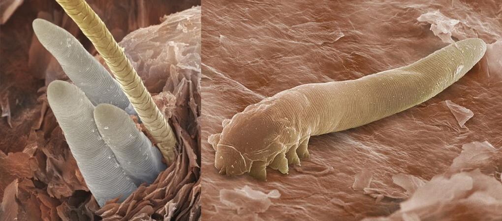 Ectoparasiti