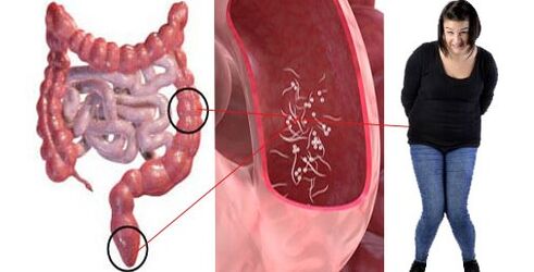 Parassiti nel corpo