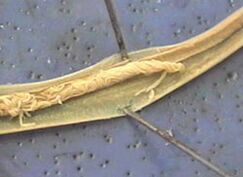 parassita